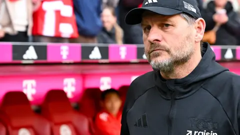 Steffen Baumgart previo al partido de Union Berlin contra Bayern Munich | AP