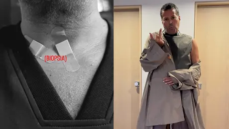 ¿Qué le pasa a Aldo Rendón? El stylist revela que fue sometido a una biopsia
