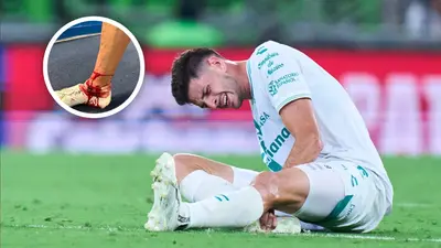 Lucas Di Yorio, baja por cuatro meses tras brutal patada en Leagues Cup