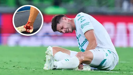 Santos prepara protesta en contra de árbitro tras entrada que lesionó a Di Yorio en la Leagues Cup