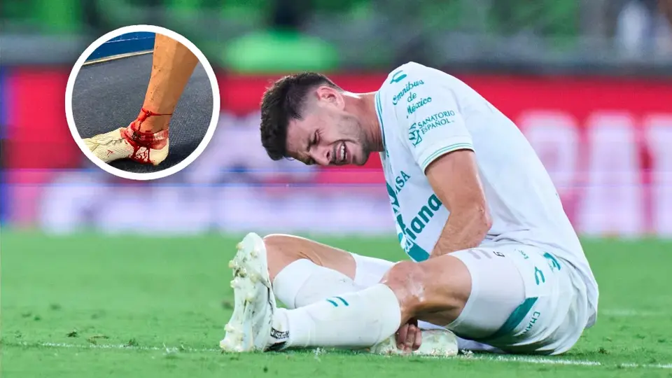 Lucas Di Yorio, baja por cuatro meses tras brutal patada en Leagues Cup