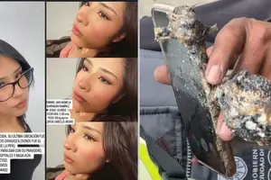 Muere Ana Daniela Barragán, víctima de la explosión de pipa en Iztapalapa