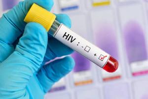 México rompe récord de contagios de VIH: 2025 supera todo el año pasado en solo 9 meses