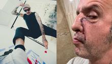 Tito de Molotov revela secuelas en su rostro: “Se me hizo mierd* la cara por drogadicto”