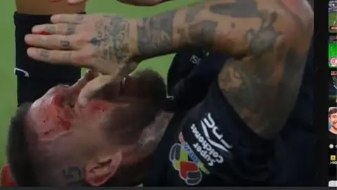Sergio Ramos comparte imágenes de su herida en la cara: "No quiero una vida sin cicatrices"