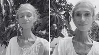 Karolina Krzyzak, la joven vegana que murió con apenas 22 kg: la historia que alerta sobre dietas extremas