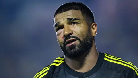 ¿Se pierde clásico ante Pumas? Rodrigo Aguirre salió con el ojo morado tras duro golpe