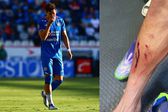 Así quedó la pierna de Orozco Chiquete tras jugada de expulsión; aficionados 'explotan' por decisión arbitral