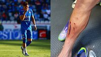 Así quedó la pierna de Orozco Chiquete tras jugada de expulsión; aficionados 'explotan' por decisión arbitral