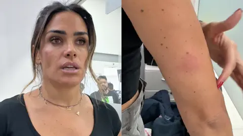 La alcaldesa Alessandra Rojo de la Vega mostró los golpes que recibió en todo el cuerpo / Especial