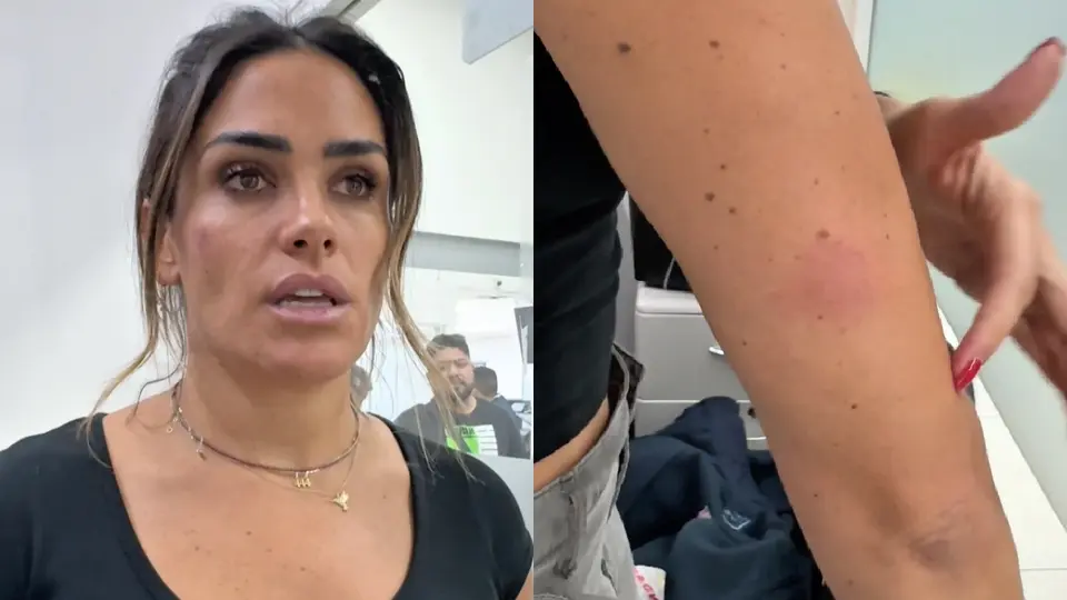 La alcaldesa Alessandra Rojo de la Vega mostró los golpes que recibió en todo el cuerpo / Especial