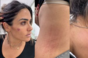 VIDEO: Alcaldesa de Cuauhtémoc acusa emboscada en operativo y muestra los golpes que recibió