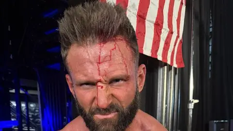 Matt Cardona presume brutal herida tras WWE Main Event: “Me sentí vivo”