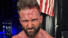 Matt Cardona presume brutal herida tras WWE Main Event: “Me sentí vivo”