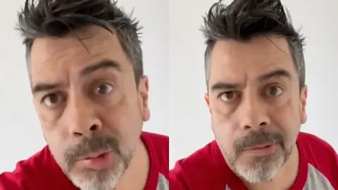 VIDEO: Carlos Espejel revela que sufre parálisis facial por estrés y tranquiliza a sus fans