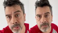VIDEO: Carlos Espejel revela que sufre parálisis facial por estrés y tranquiliza a sus fans