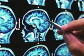 La pandemia envejeció tu cerebro más rápido, incluso si no te contagiaste, según estudio