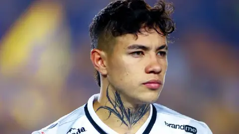 Emilio Lara es operado tras fractura desafortunada; Necaxa explicó lo que sucedió con el jugador