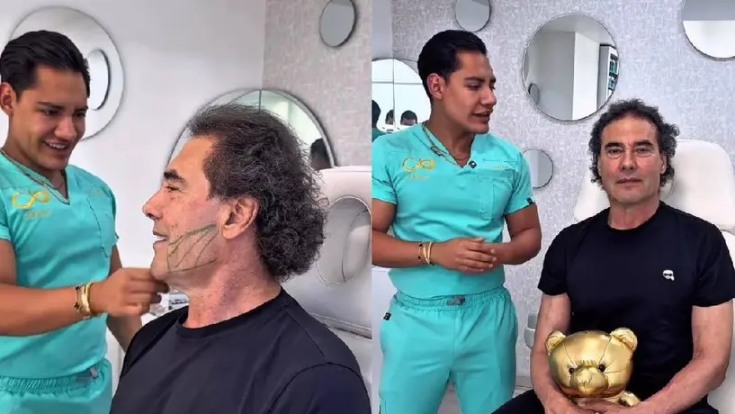 Eduardo Yáñez sorprende con rejuvenecimiento facial de alto impacto a los 64 años