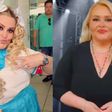 Así luce Sheyla, comediante que bajó más de 50 kilos y donó su piel a pacientes graves