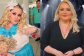 Así luce Sheyla, comediante que bajó más de 50 kilos y donó su piel a pacientes graves