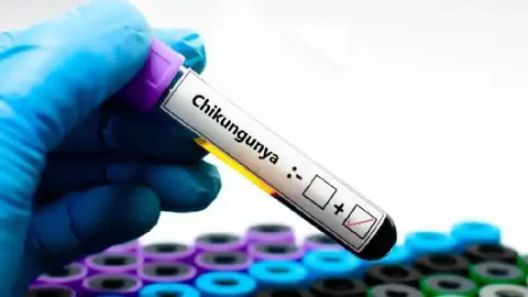 ¿Nueva pandemia? Reportan 7 mil casos de chikungunya en China