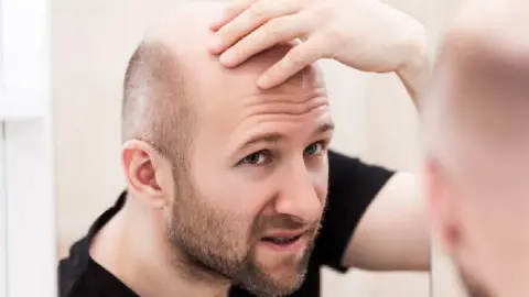 ¿La cura para la calvicie? Científicos de UCLA crean crema que reactiva el crecimiento del cabello