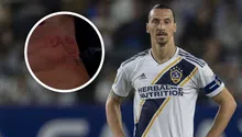Zlatan Ibrahimovic se somete a tratamiento para borrar su tatuaje icónico