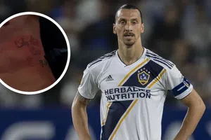 Zlatan Ibrahimovic se somete a tratamiento para borrar su tatuaje icónico