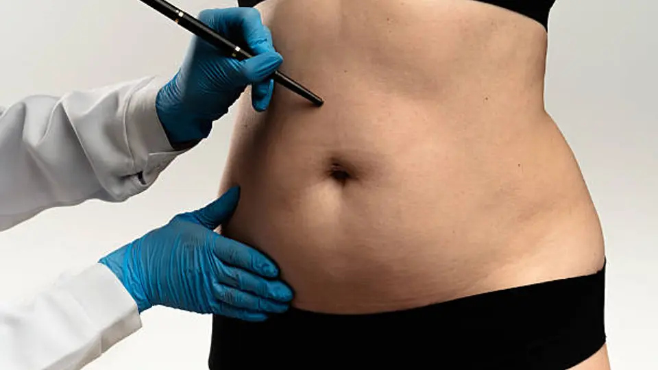 La investigación deberá establecer si hubo alguna irregularidad durante la cirugía estética./ Pixabay