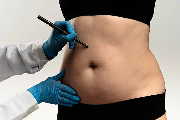 La investigación deberá establecer si hubo alguna irregularidad durante la cirugía estética./ Pixabay