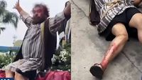 VIDEO: Barrabás se rompe la pierna en plena representación de la Pasión de Cristo