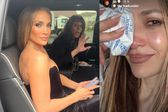 Jennifer Lopez aparece con el rostro golpeado ¿Qué sucedió?