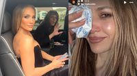 Jennifer Lopez aparece con el rostro golpeado ¿Qué sucedió?