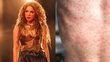 Asistentes al show de Shakira en riesgo por sarampión: autoridades piden precaución