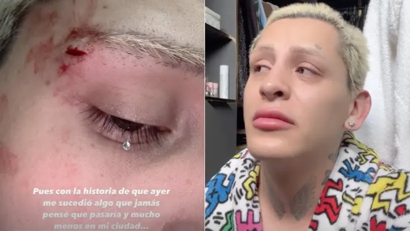 Golpean a Kunno tras salir de un antro en Monterrey; denuncia ataque homofóbico