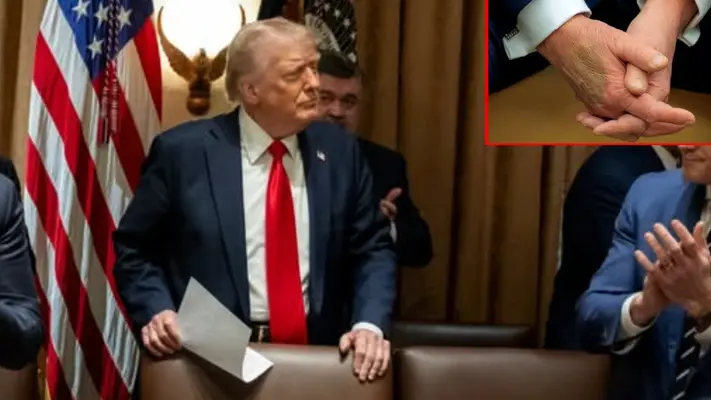 El misterioso moretón en la mano de Donald Trump: ¿qué hay detrás?