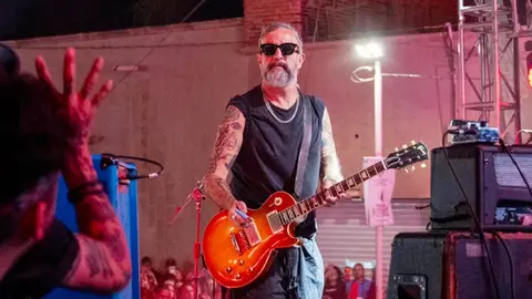 Tito Fuentes de Molotov: “El lunes tengo una intervención quirúrgica en la carátula”