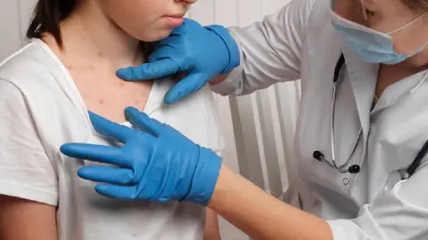 Secretaria de Salud confirma 362 casos de sarampión en México