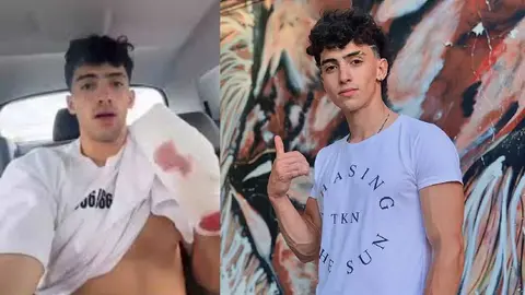 Influencer Gero Arias sufre caída de 10 metros y pierde dos dedos de la mano