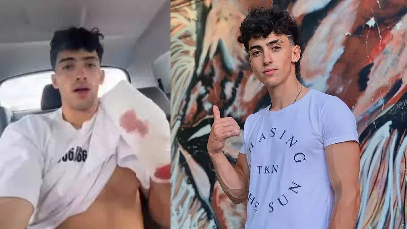 Influencer Gero Arias sufre caída de 10 metros y pierde dos dedos de la mano