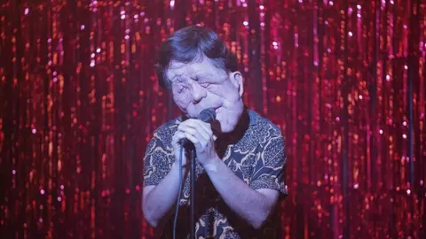 Adam Pearson ha utilizado su carrera como actor para visibilizar la neurofibromatosis tipo 1./ AP