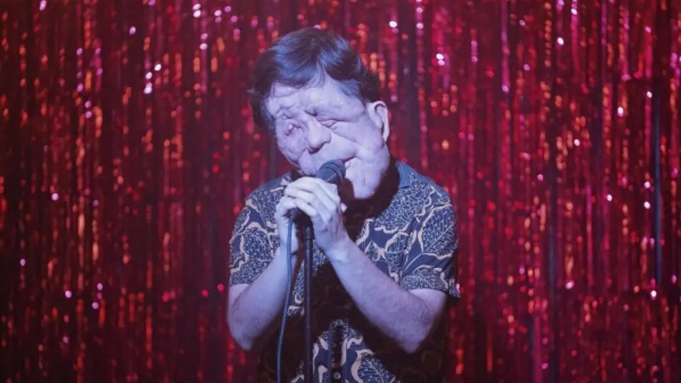 Adam Pearson ha utilizado su carrera como actor para visibilizar la neurofibromatosis tipo 1./ AP