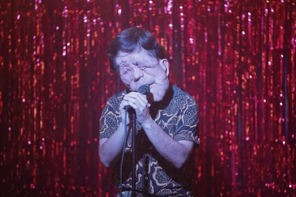Adam Pearson ha utilizado su carrera como actor para visibilizar la neurofibromatosis tipo 1./ AP