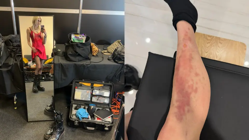 Taylor Momsen fue mordida por una araña en el primer concierto de AC/DC en el Estadio GNP Seguros / IG: @taylormomsen