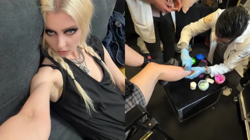 Los accidente con las mordeduras no son nada nuevo para la rockera pues ya es el segundo caso que experimenta / IG: @taylormomsen