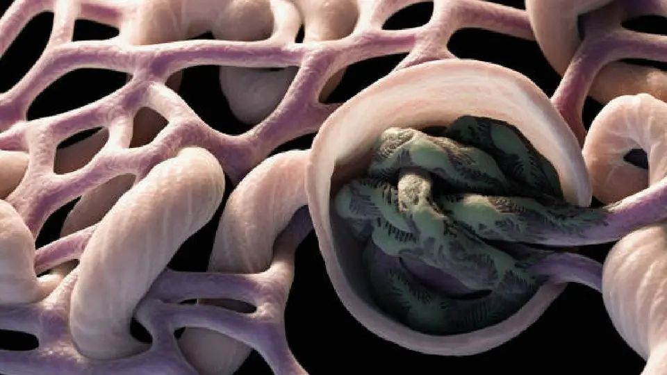 La ciclosporosis es una infección intestinal causada por el parásito microscópico Cyclospora cayetanensis. / iStock