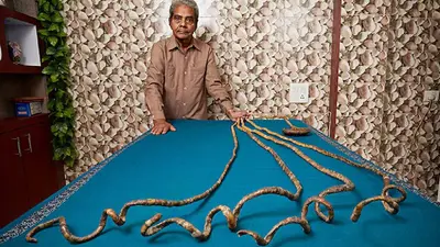 ¿Quién es Shridhar Chillal? El hombre que dejó crecer sus uñas 66 años y logró un sorprendente Récord Guinness