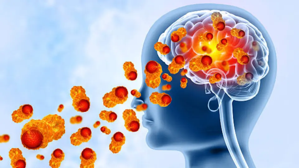 Dolor de cabeza, fiebre, náuseas y vómitos pueden aparecer en las primeras etapas de la infección. / iStock