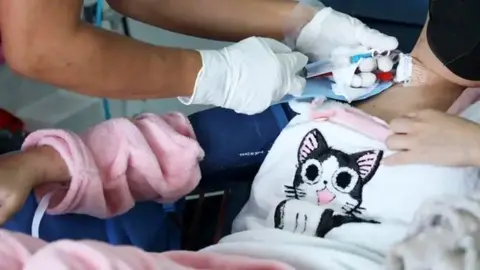 La SSA emite alerta epidemiológica por la bacteria “Klebsiella oxytoca”, hay 15 casos confirmados